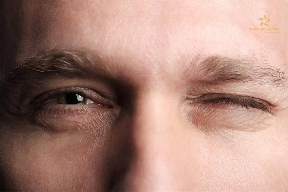 Mắt trái giật là điềm gì? Làm gì khi mắt bị giật liên tục?